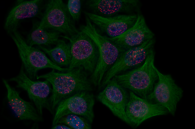 Senescent cells with DNA damage markers