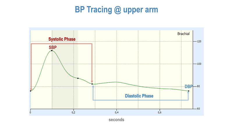 Blood pressure variability illustration