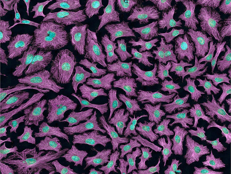 Multiphoton fluorescence image illustrating neuronal structures